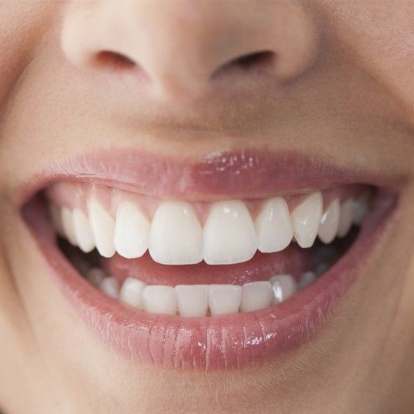 Sourire naturel